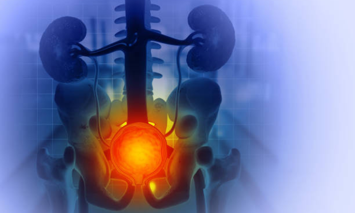 Kidney and Bladder cancer treatment in Bangalore