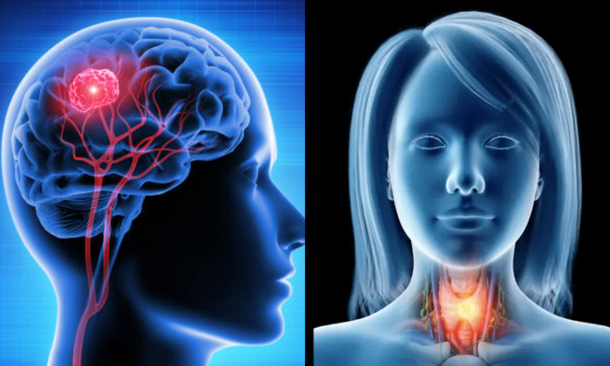 Head and neck cancer treatment in Bangalore
