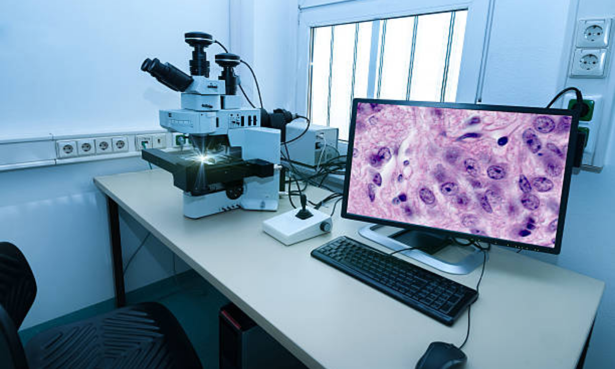 Cancer Diagnosis and Screening Services in Bangalore