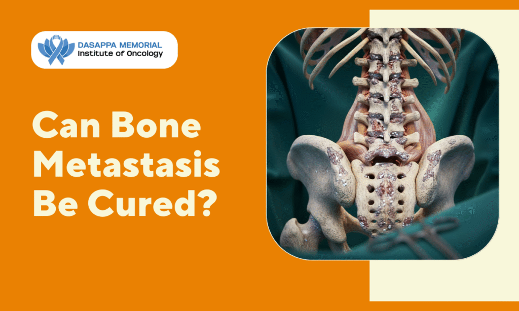 Can Bone Metastasis Be Cured? - Dasappa Memorial Institute of Oncology