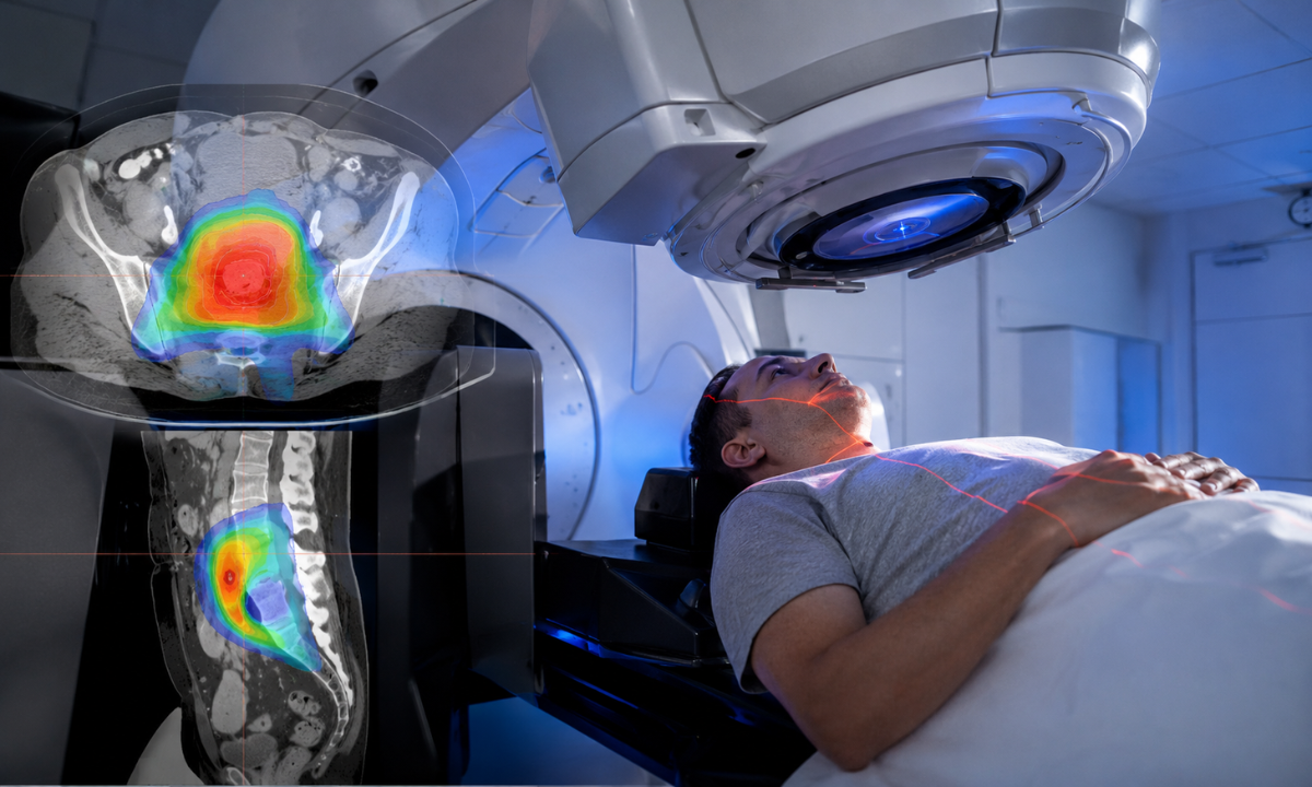Higher Radiation Precision