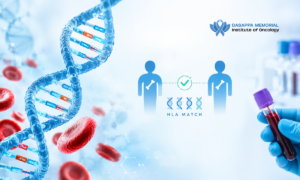 Bone marrow transplant donor matching with HLA testing and donor compatibility