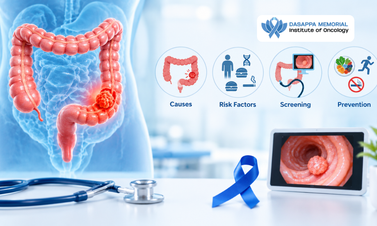 Colorectal cancer causes, risk factors, screening, and prevention methods